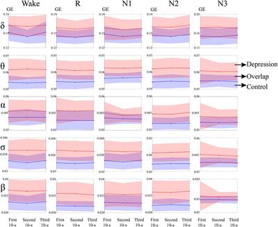 Graph Theory Analysis of the Cortical Functional Network During Sleep in Patients With Depression